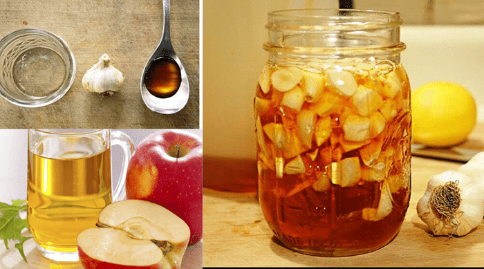 Ail, Miel et Vinaigre de cidre de pomme:  Excellent remède à la maison