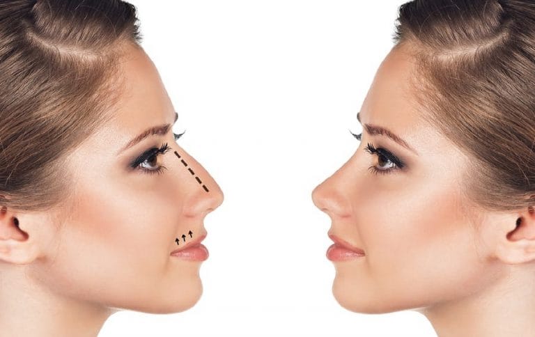 Comment avoir un nez plus petit sans chirurgie - Astuces de grand-mère