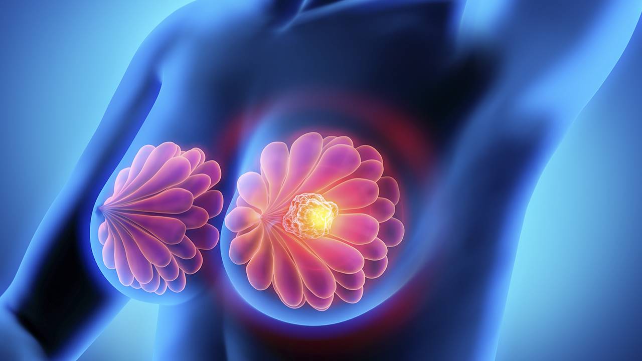 traitements alternatifs contre le cancer