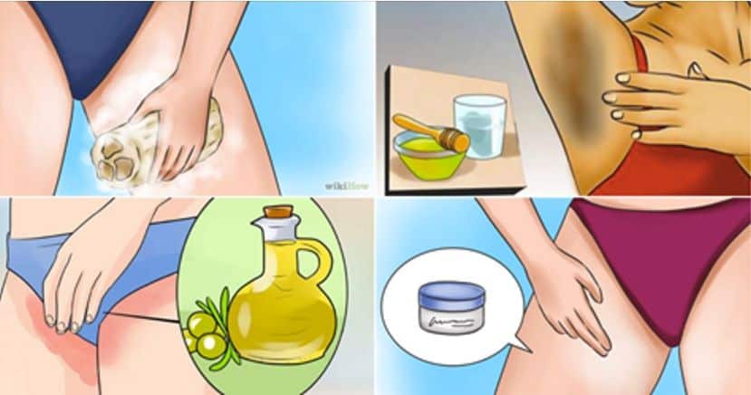 blanchir les parties intimes