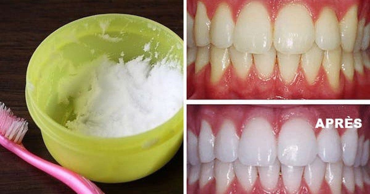 15 façons d'utiliser le bicarbonate de soude pour le blanchiment des — free download