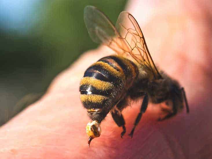 Piqûres d'abeilles