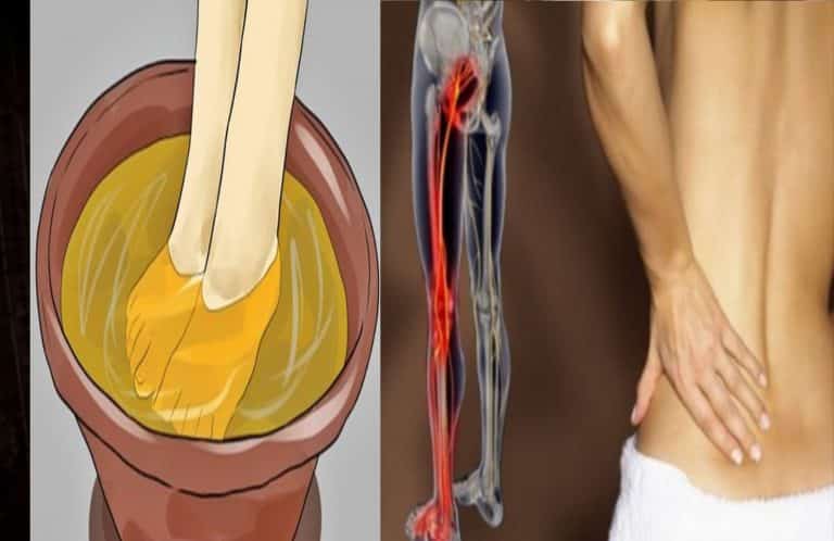 Comment soulager la douleur du nerf sciatique avec le vinaigre de cidre