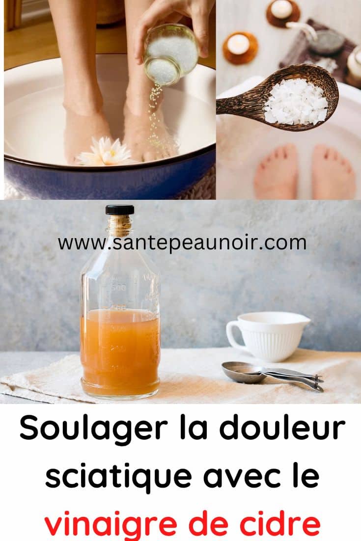 vinaigre de cidre et nerf sciatique