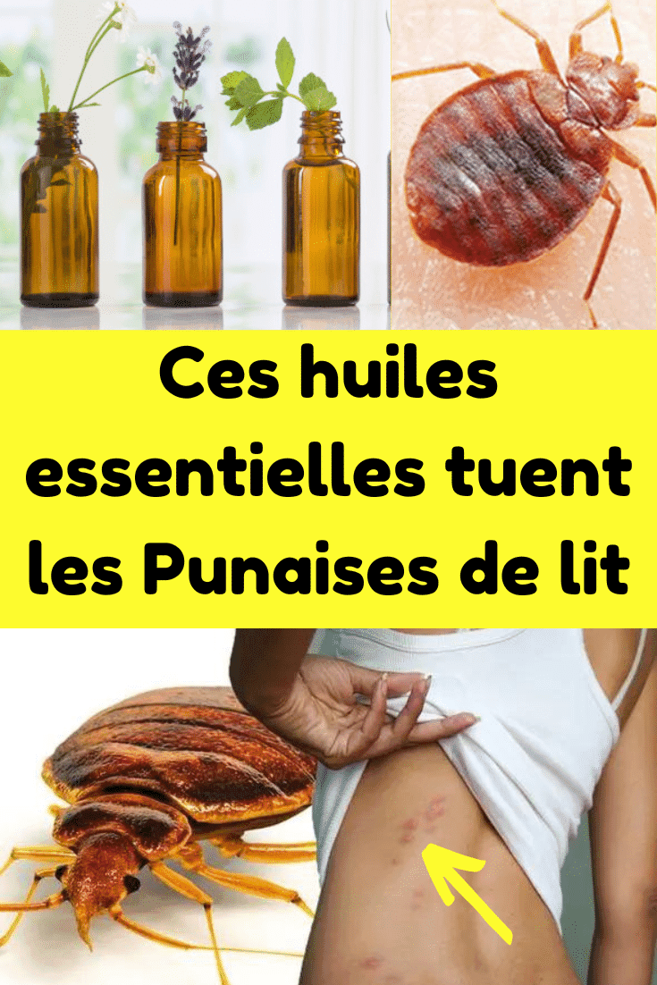 Punaise De Lit Huile Essentielle Avis