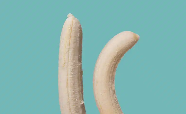 traitement du pénis tordus