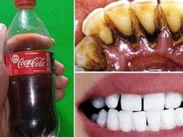 coca cola pour blanchir les dents
