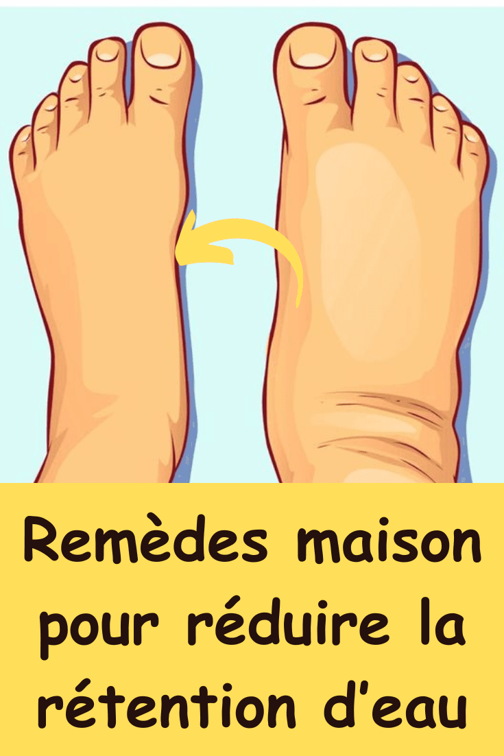 remedes maison rétention d’eau
