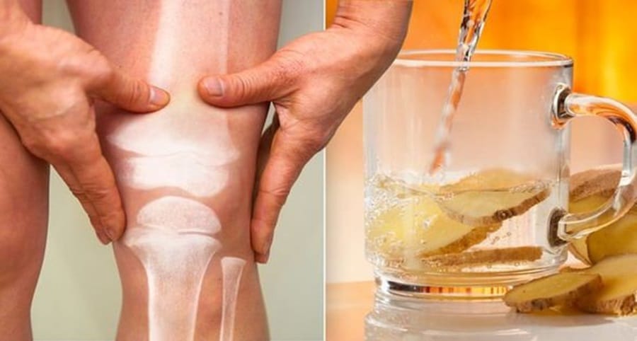 Eau citronnée contre arthrite