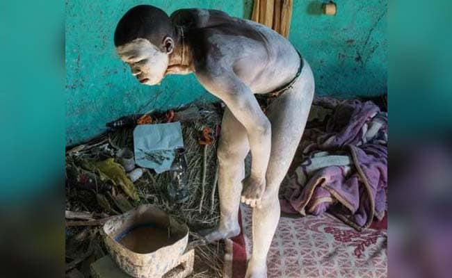 Renforcer la Vitalité Masculine