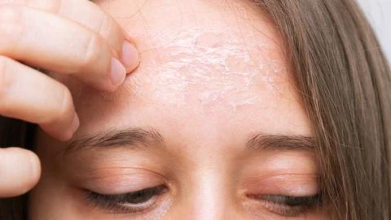 hydrater une peau sèche