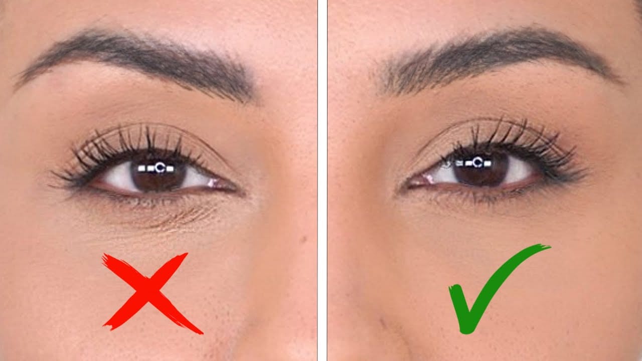 reduce fine lines around the eyes